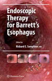 Endoscopic Therapy for Barrett's Esophagus