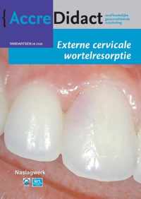 AccreDidact TA2020-4 -   Externe cervicale wortelresorptie