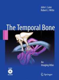 Temporal Bone