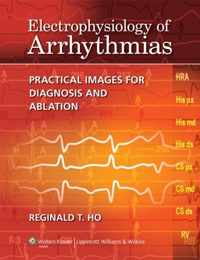 Electrophysiology of Arrhythmias