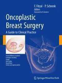 Oncoplastic Breast Surgery