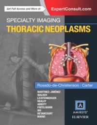 Specialty Imaging: Thoracic Neoplasms