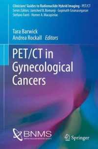 PET/CT in Gynecological Cancers