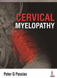 Cervical Myelopathy