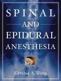 Spinal and Epidural Anesthesia