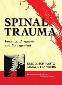 Imaging of Spine Trauma