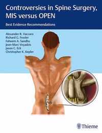 Controversies in Spine Surgery: MIS versus OPEN
