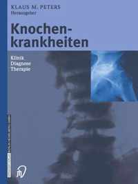 Knochenkrankheiten