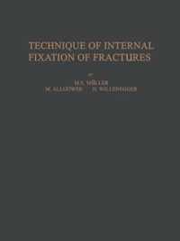 Technique of Internal Fixation of Fractures