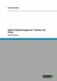 Agiles Projektmanagement - Kanban und Scrum