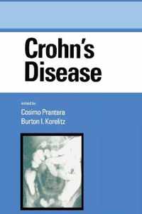 Crohn's Disease