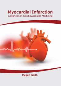 Myocardial Infarction