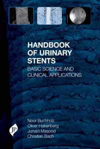 Handbook of Urinary Stents