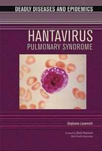 Hantavirus Pulmonary Syndrome