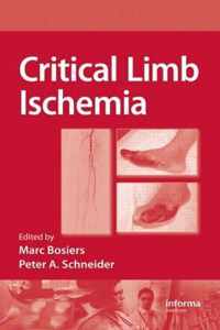 Critical Limb Ischemia