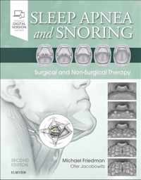 Sleep Apnea and Snoring