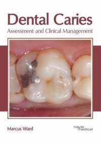 Dental Caries