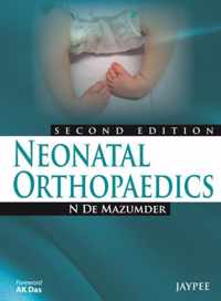 Neonatal Orthopaedics