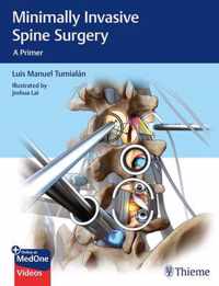 Minimally Invasive Spine Surgery