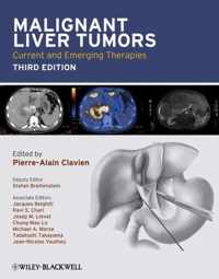 Malignant Liver Tumors