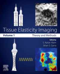 Tissue Elasticity Imaging