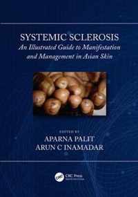 Systemic Sclerosis