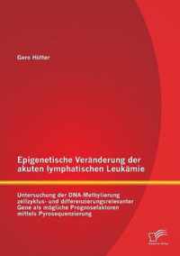 Epigenetische Veranderung der akuten lymphatischen Leukamie