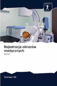 Rejestracja obrazow medycznych