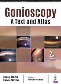 Gonioscopy