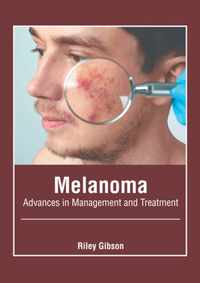 Melanoma