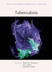 Tuberculosis