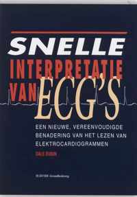 Snelle interpretatie van ecg's