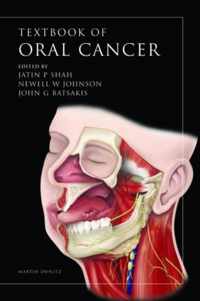 Oral Cancer