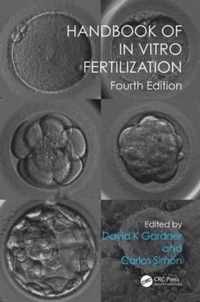 Handbook of In Vitro Fertilization