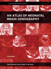 An Atlas of Neonatal Brain Sonography