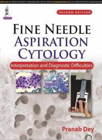 Fine Needle Aspiration Cytology