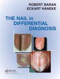 Nail in Differential Diagnosis