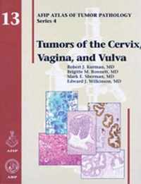 Tumors of the Cervix, Vagina, and Vulva