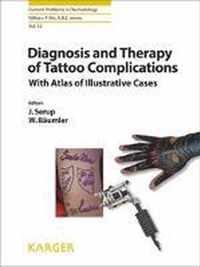 Diagnosis and Therapy of Tattoo Complications