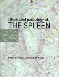 Illustrated Pathology of the Spleen