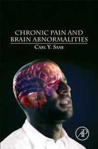 Chronic Pain and Brain Abnormalities