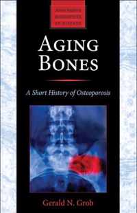 Aging Bones