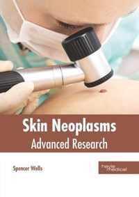 Skin Neoplasms