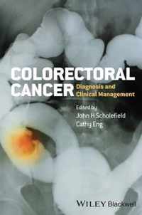 Colorectal Cancer