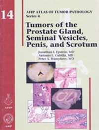 Tumors of the Prostate Gland, Seminal Vesicles, Penis, and Scrotum