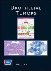 UROTHELIAL TUMORS