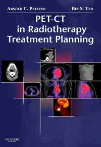 PET-CT in Radiotherapy Treatment Planning