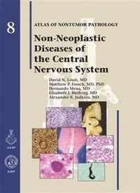 Non-Neoplastic Diseases of the Central Nervous System