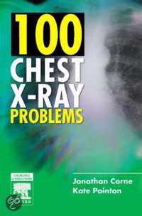 100 Chest X-Ray Problems