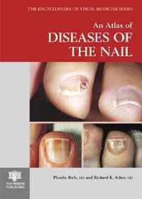 An Atlas of Diseases of the Nail